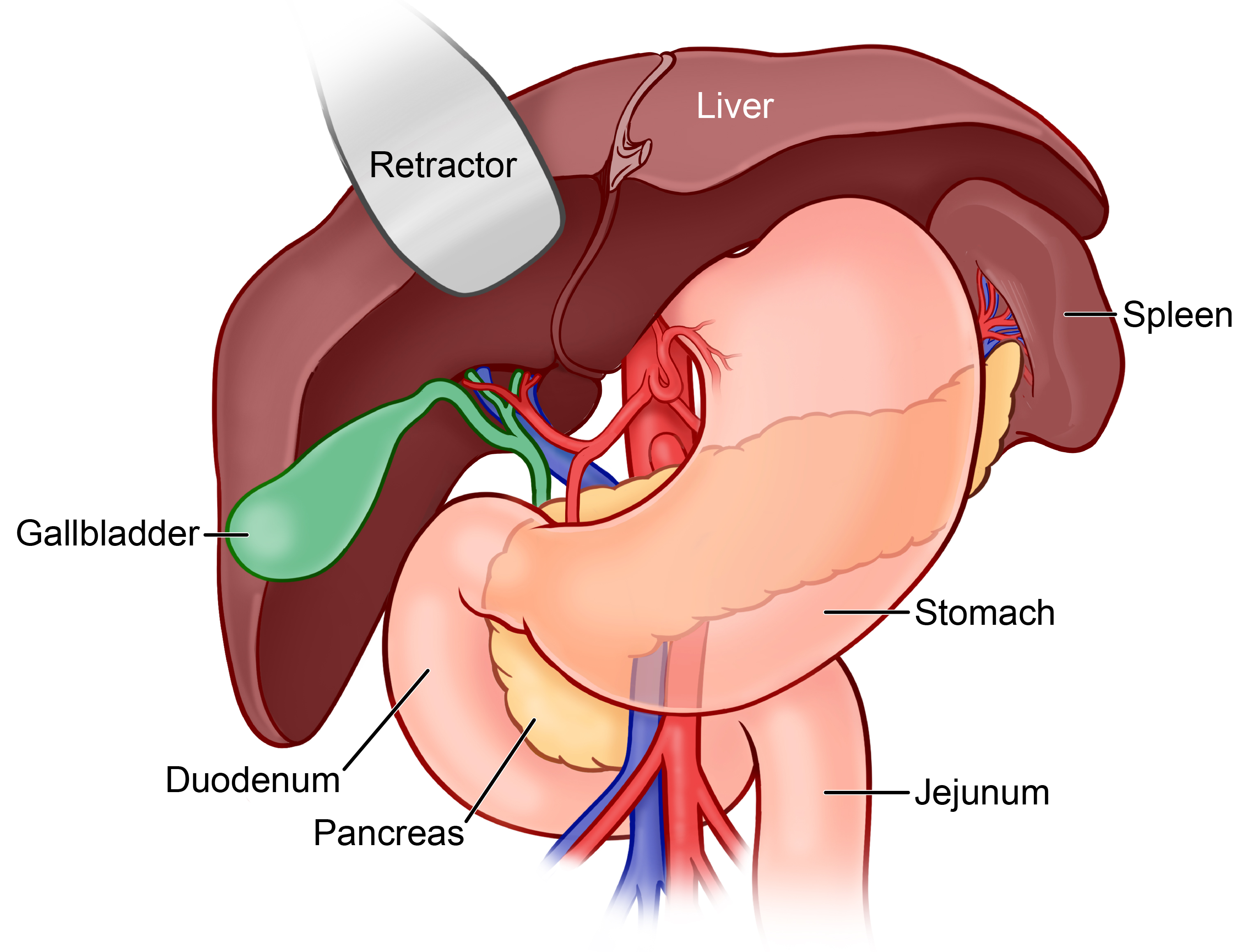 Illustration of pancreas anatomy showing its relationship to the liver, stomach, duodenum, gallbladder, spleen, and jejunum